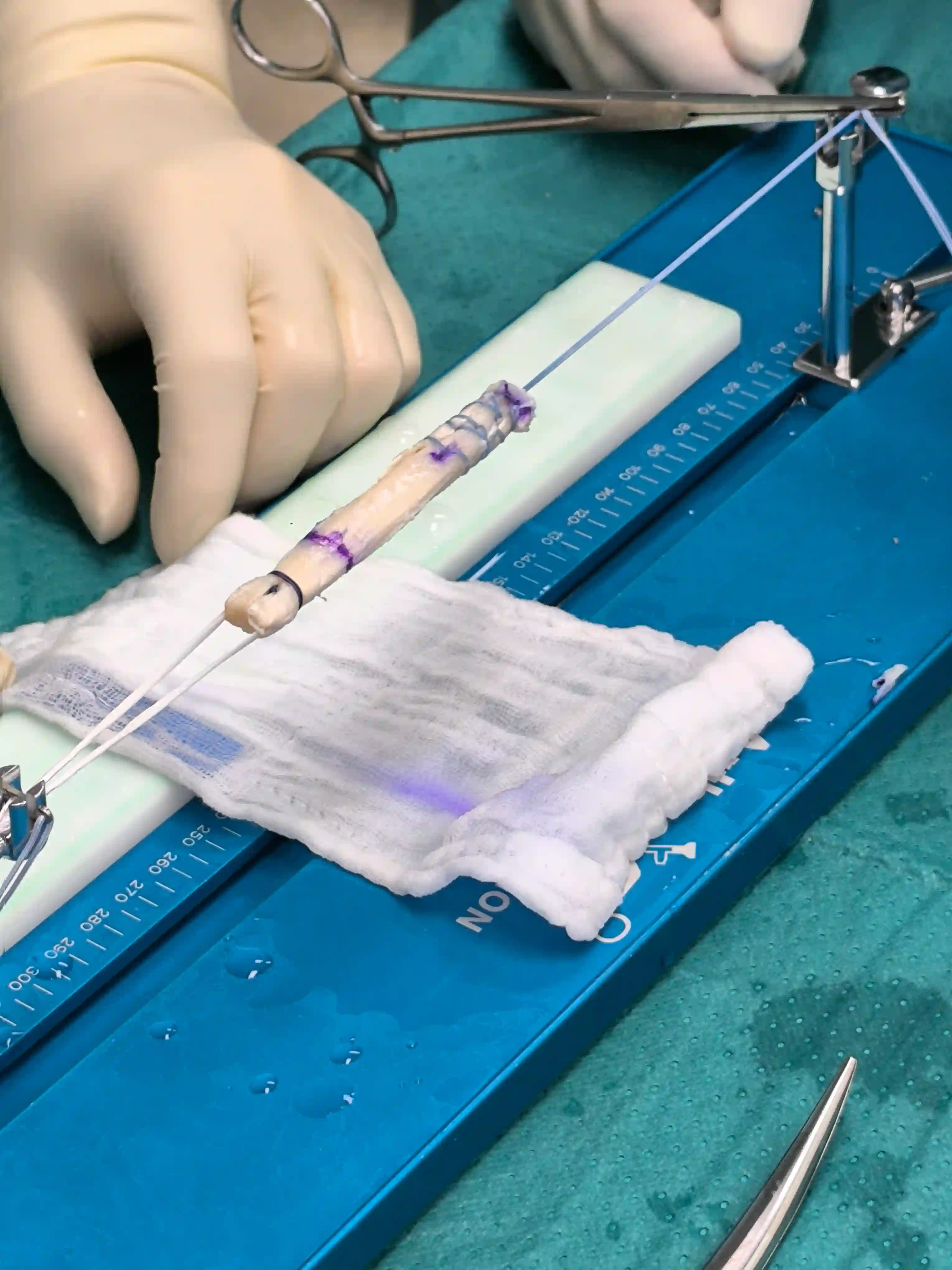 Arthroskopische Kreuzband-OP im Operationssaal – Arthroskop und Instrumente im Kniegelenk